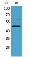 AACT Rabbit Polyclonal Antibody
