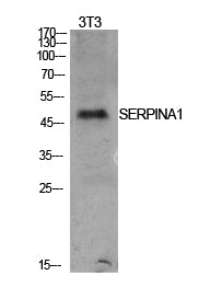 AAT Rabbit Polyclonal Antibody