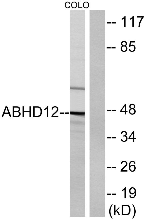 ABHD12 Rabbit Polyclonal Antibody