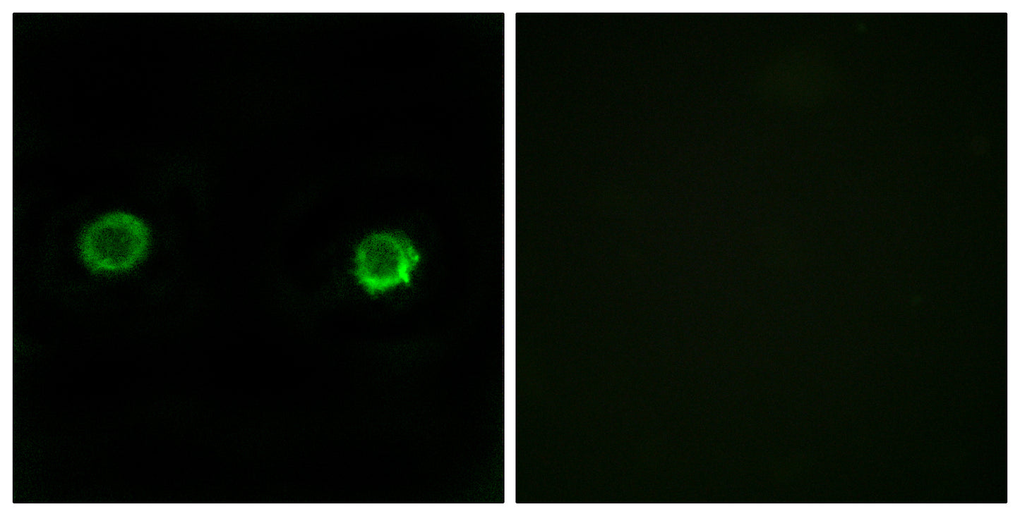 ABHD2 Rabbit Polyclonal Antibody