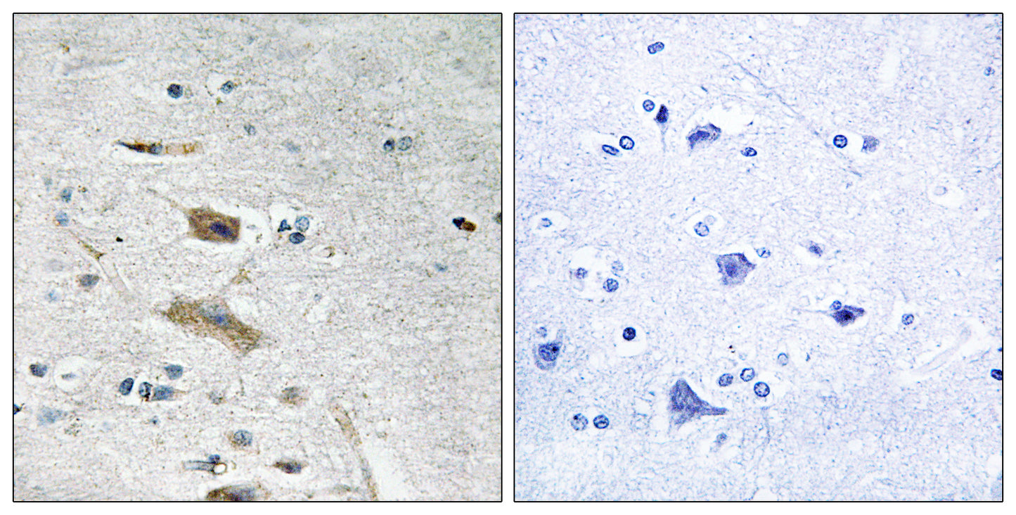 ABHD4 Rabbit Polyclonal Antibody