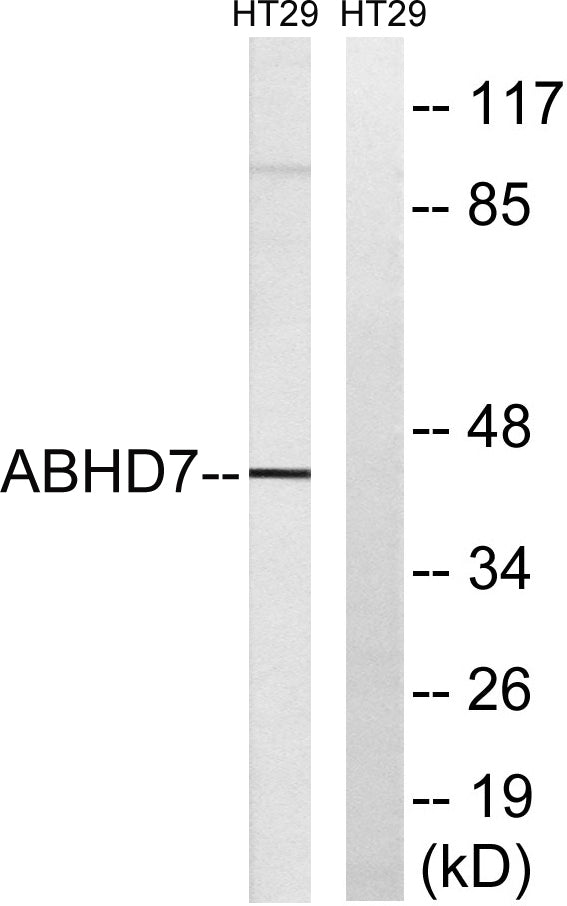 ABHD7 Rabbit Polyclonal Antibody