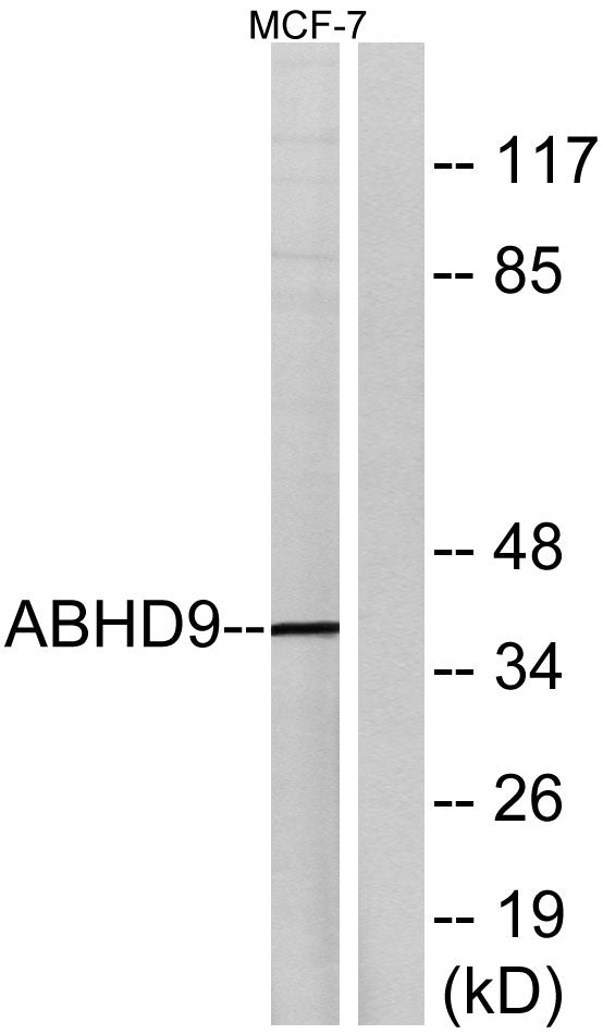 ABHD9 Rabbit Polyclonal Antibody