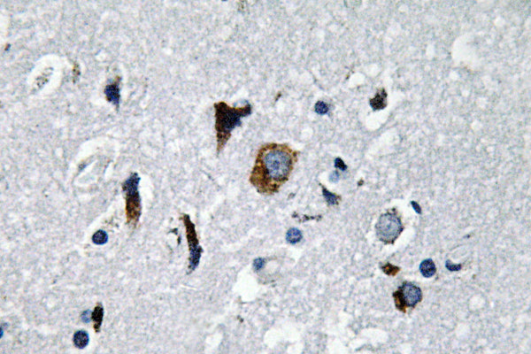 ACE1 Rabbit Polyclonal Antibody