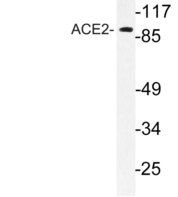 ACE2 Rabbit Polyclonal Antibody