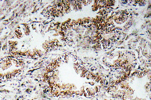 AChRα1 Rabbit Polyclonal Antibody