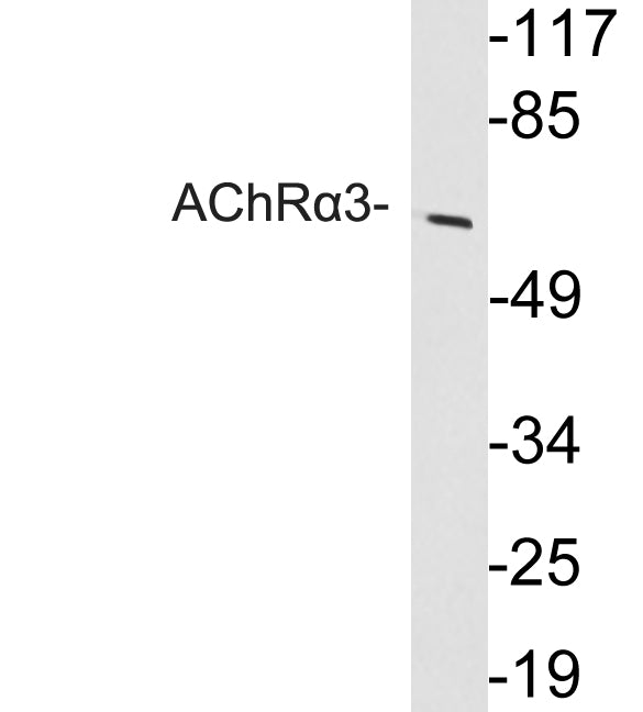 AChRα3 Rabbit Polyclonal Antibody