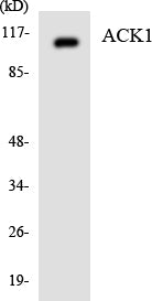ACK Rabbit Polyclonal Antibody