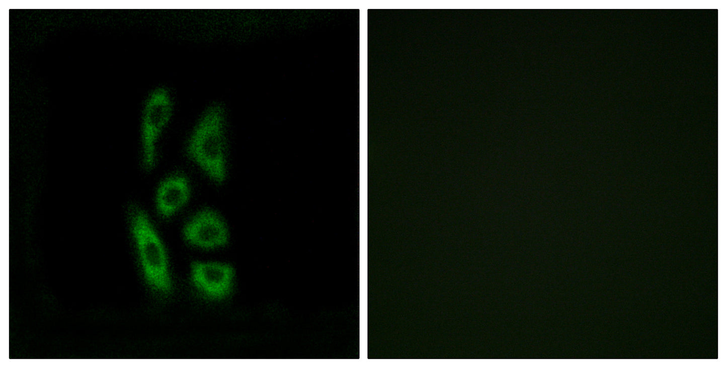 ACOT12 Rabbit Polyclonal Antibody