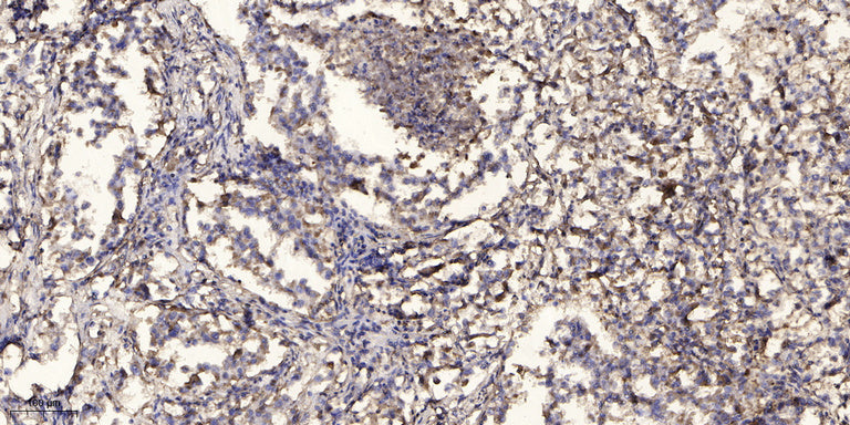 ACOT9 Rabbit Polyclonal Antibody
