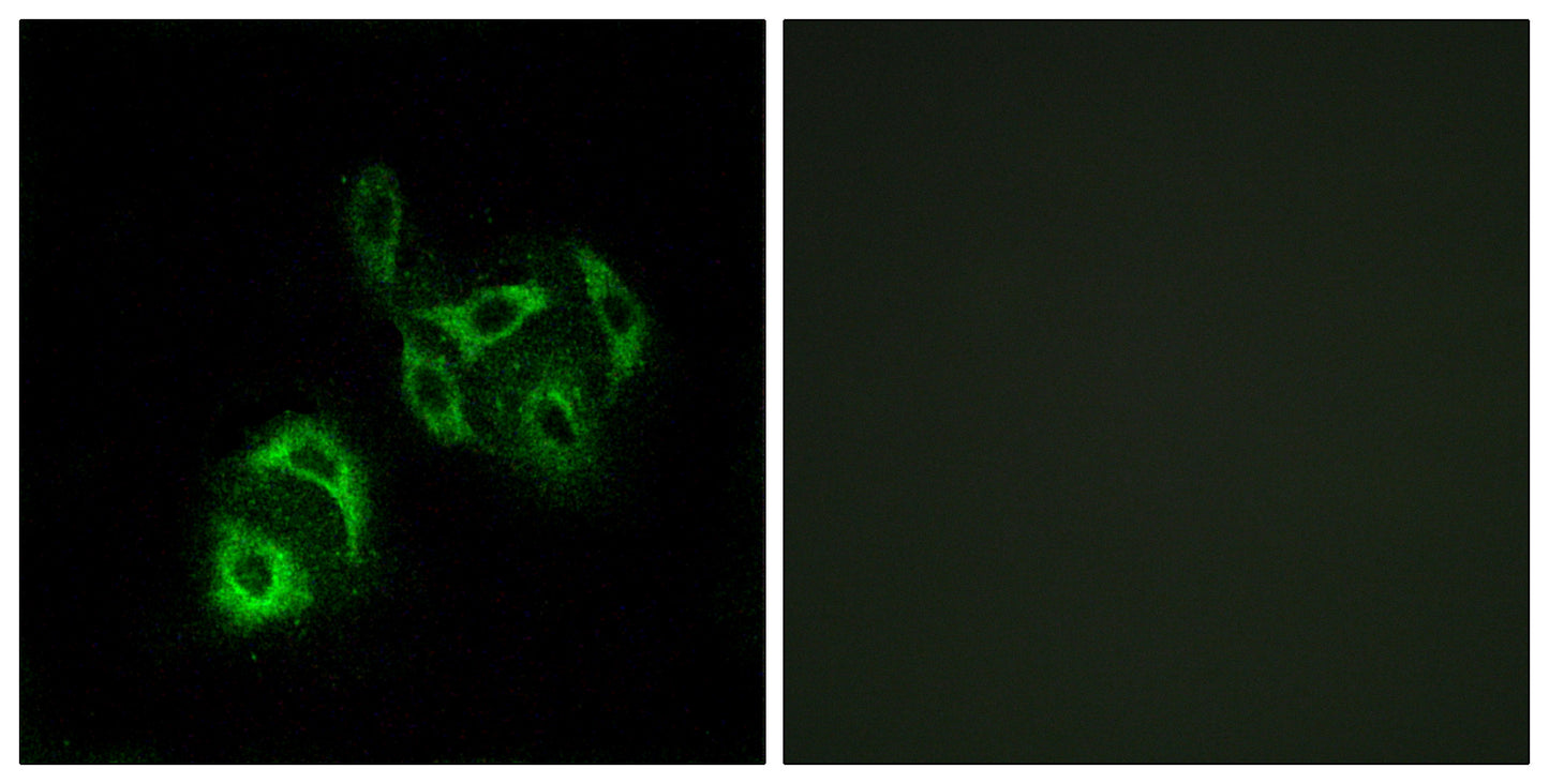 ACSVL4 Rabbit Polyclonal Antibody