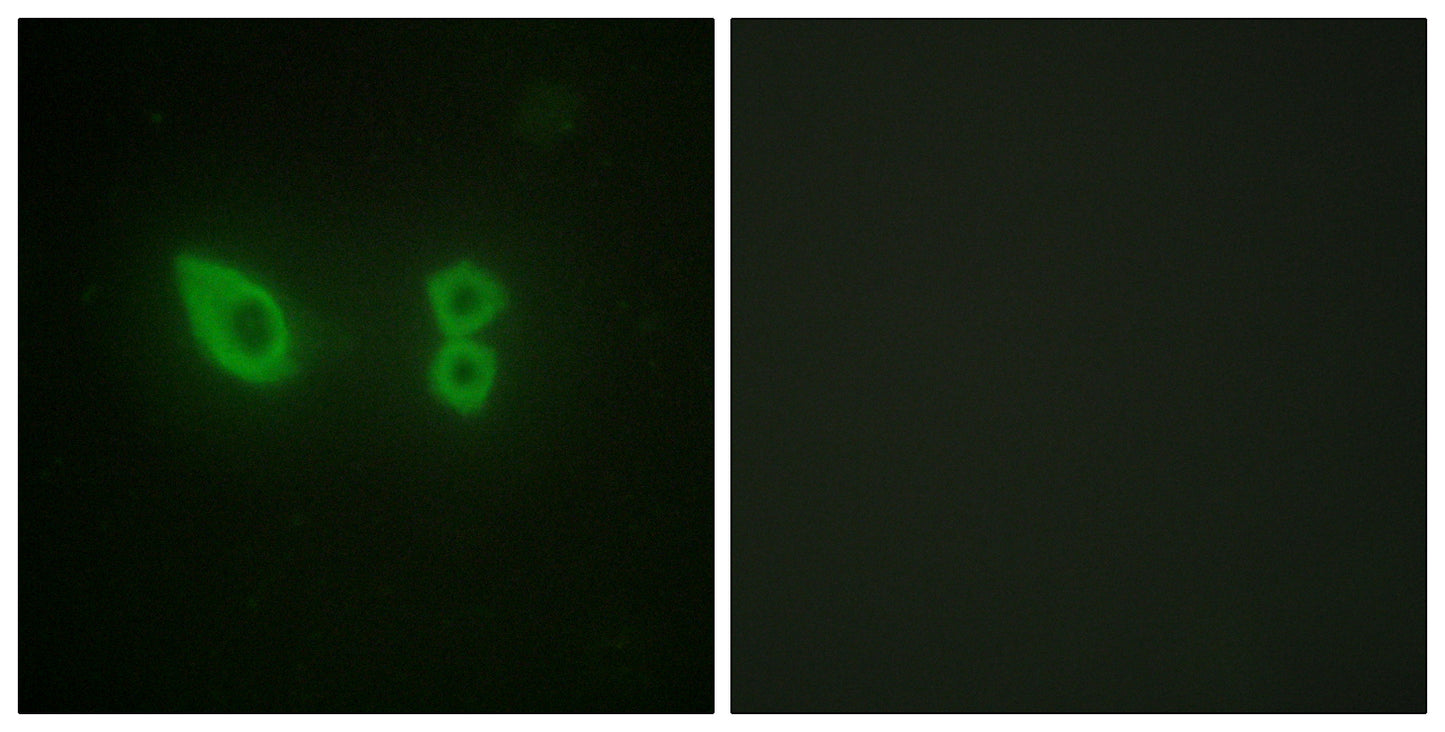 Actinin-α2/3 Rabbit Polyclonal Antibody
