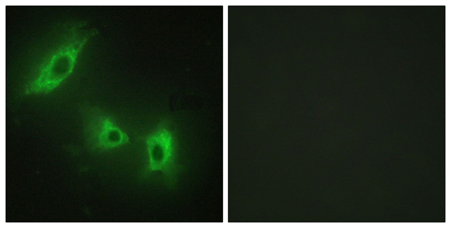 ACTR-IB Rabbit Polyclonal Antibody