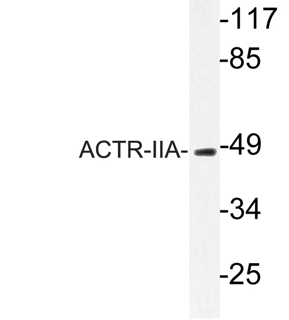 ACTR-IIA Rabbit Polyclonal Antibody