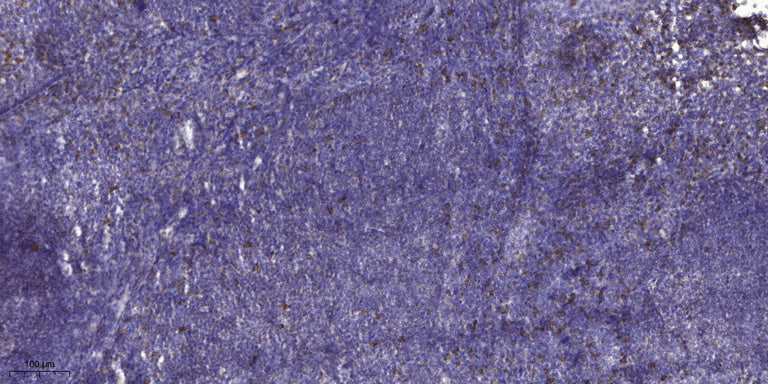 ADAMTS-17 Rabbit Polyclonal Antibody