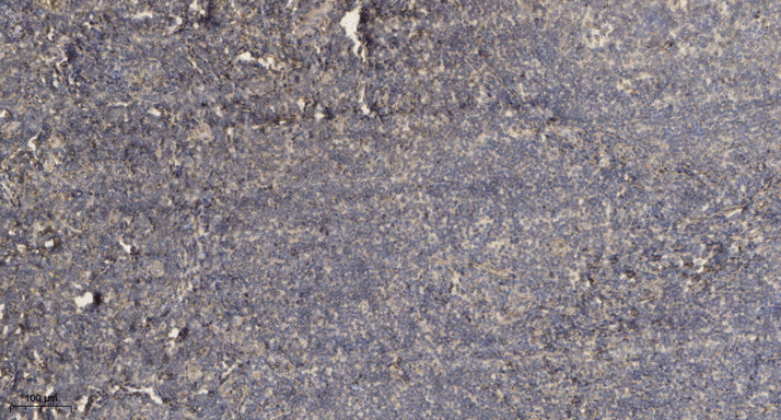 ADAMTS-7 Rabbit Polyclonal Antibody