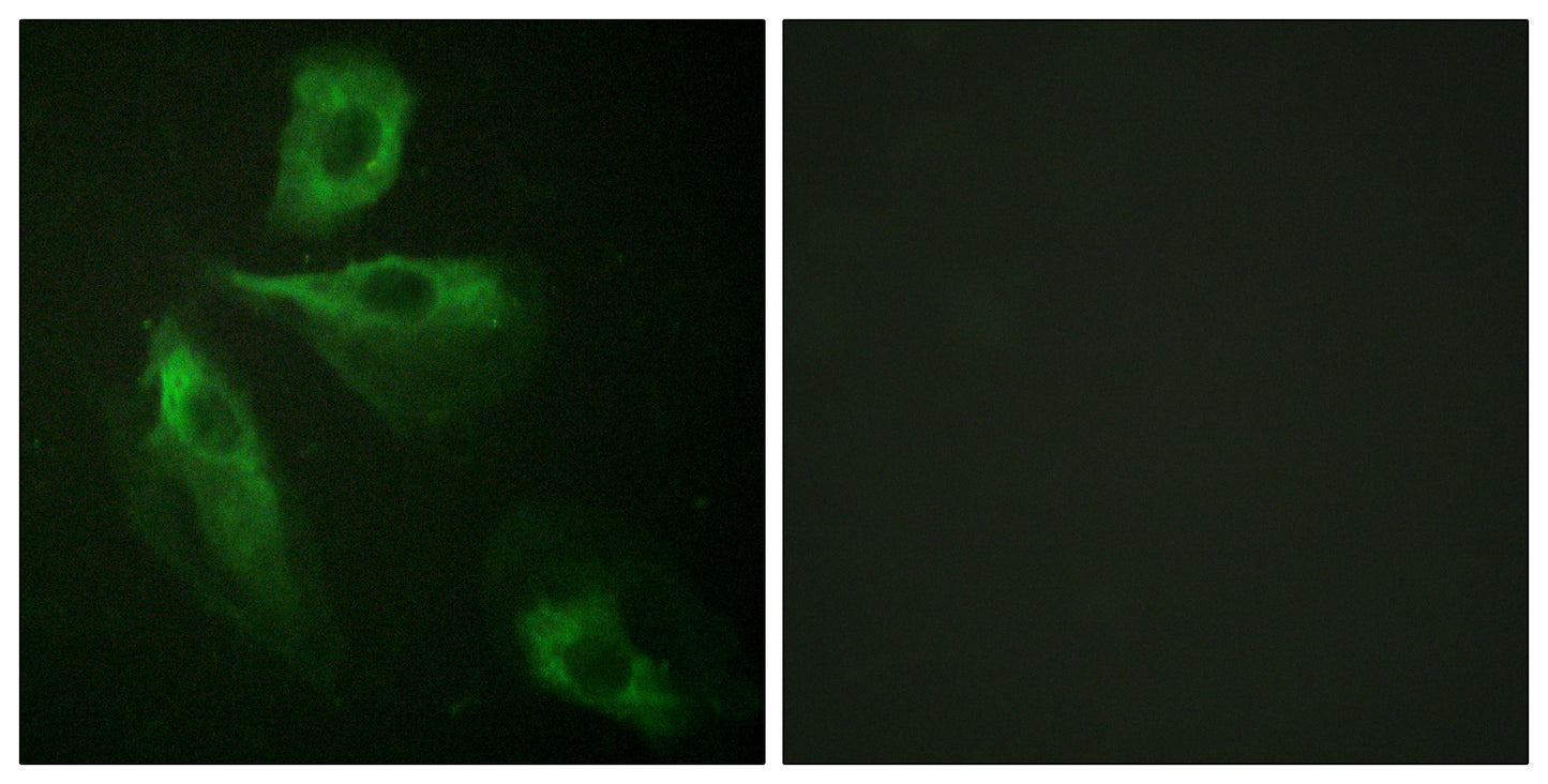 ADD1 Rabbit Polyclonal Antibody