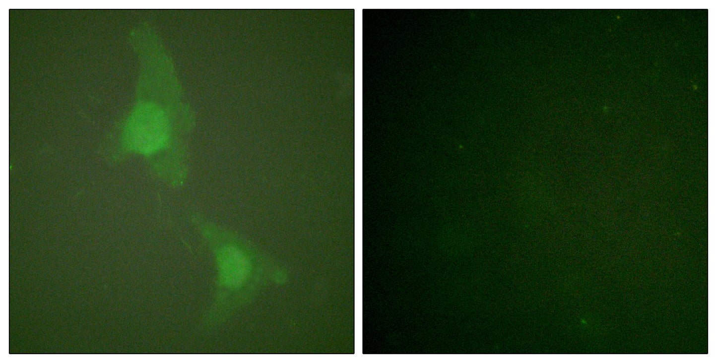 Adducin α/β Rabbit Polyclonal Antibody