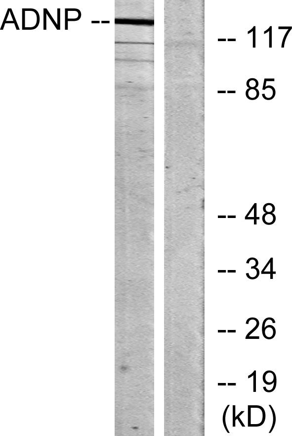 ADNP Rabbit Polyclonal Antibody