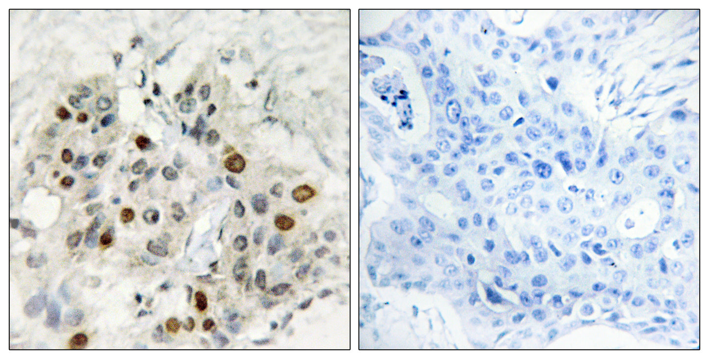 AF-4 Rabbit Polyclonal Antibody