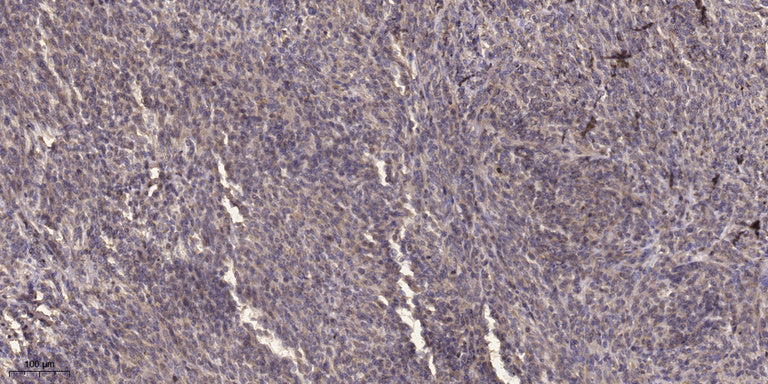 AGS3 Rabbit Polyclonal Antibody