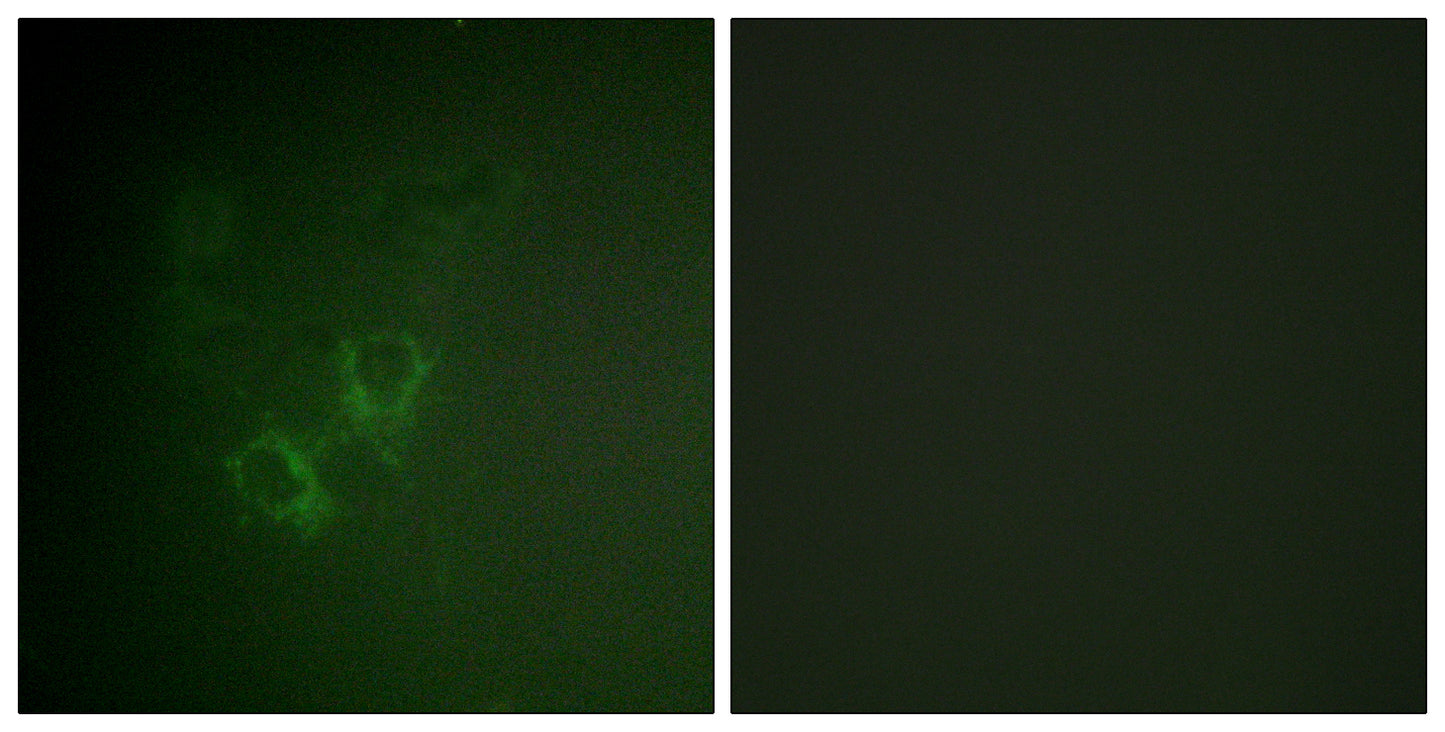 Ah Receptor Rabbit Polyclonal Antibody