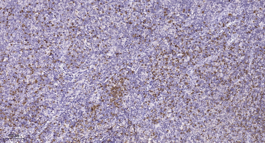 AHNK Rabbit Polyclonal Antibody