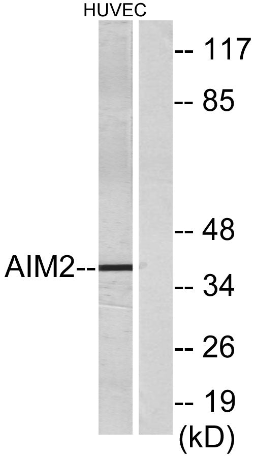 AIM2 Rabbit Polyclonal Antibody