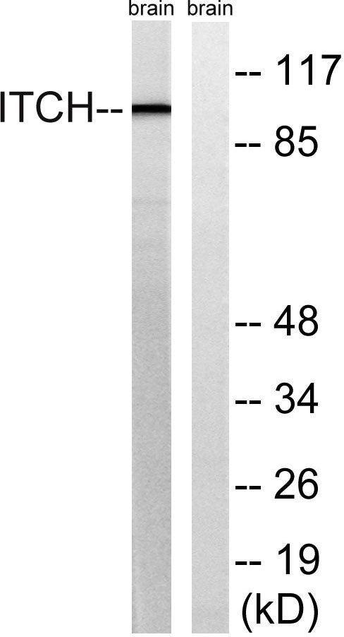 AIP4 Rabbit Polyclonal Antibody