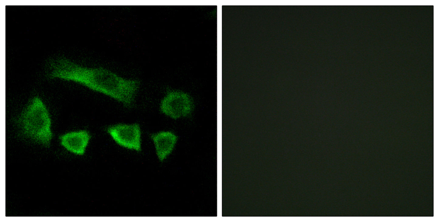 AIRP Rabbit Polyclonal Antibody