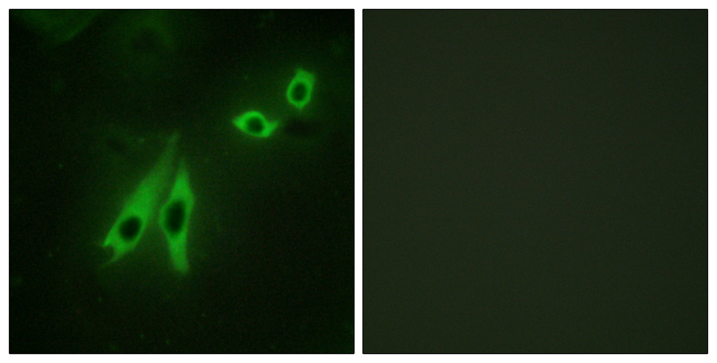 AKAP 110 Rabbit Polyclonal Antibody