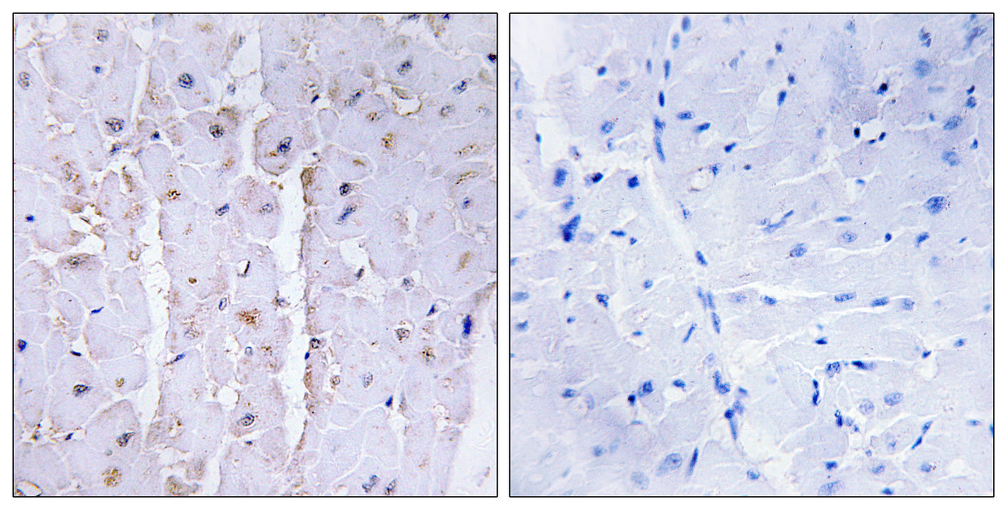 AKAP 13 Rabbit Polyclonal Antibody
