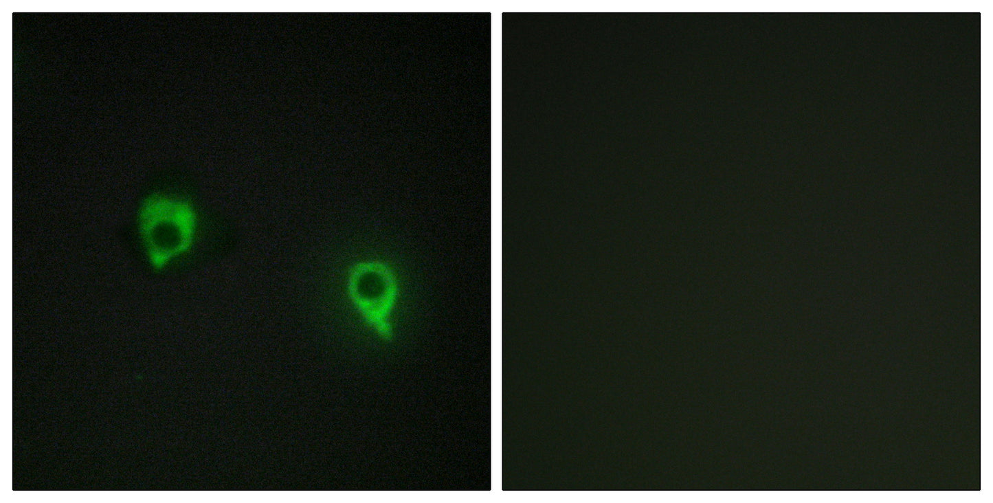 AKAP 149 Rabbit Polyclonal Antibody