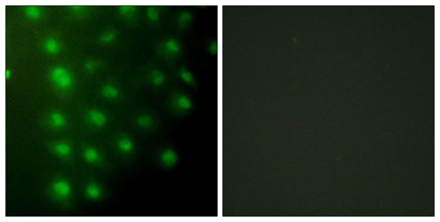 AKAP 95 Rabbit Polyclonal Antibody