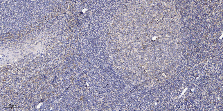 AKAP9 Rabbit Polyclonal Antibody