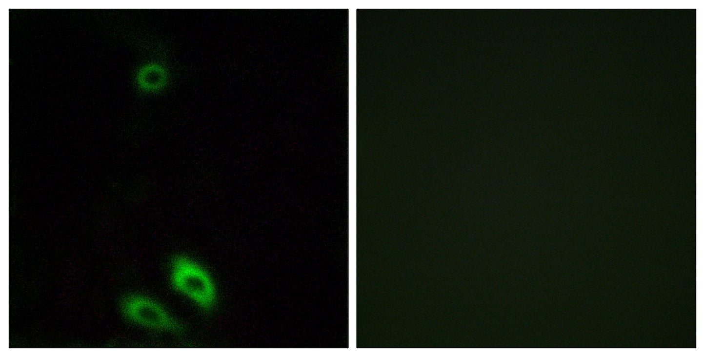 AKR1CL1 Rabbit Polyclonal Antibody