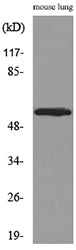 ALDH1A1 Rabbit Polyclonal Antibody