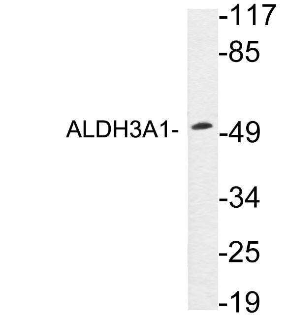 ALDH3A1 Rabbit Polyclonal Antibody