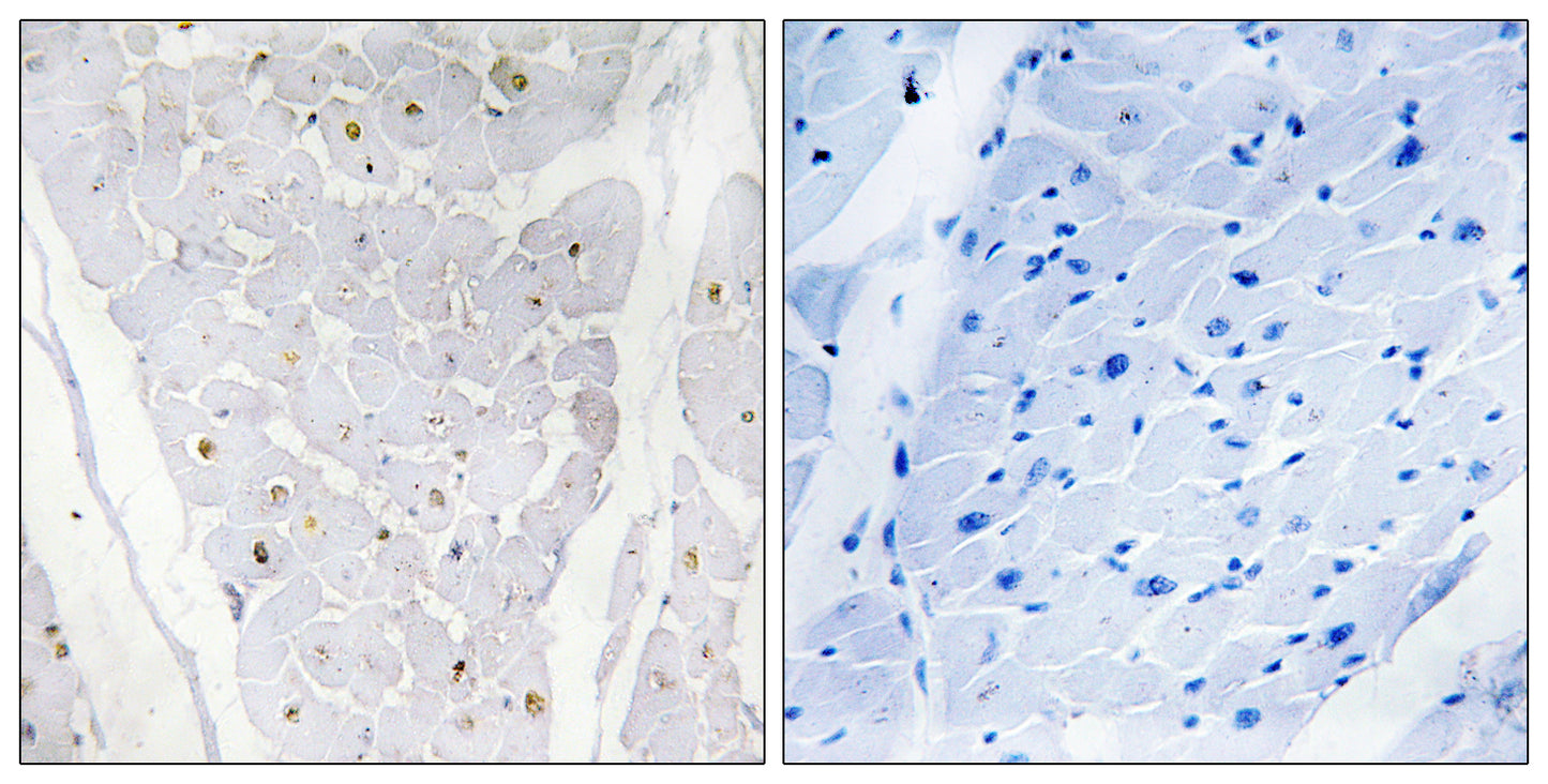 Alpha-protein Kinase 2 Rabbit Polyclonal Antibody