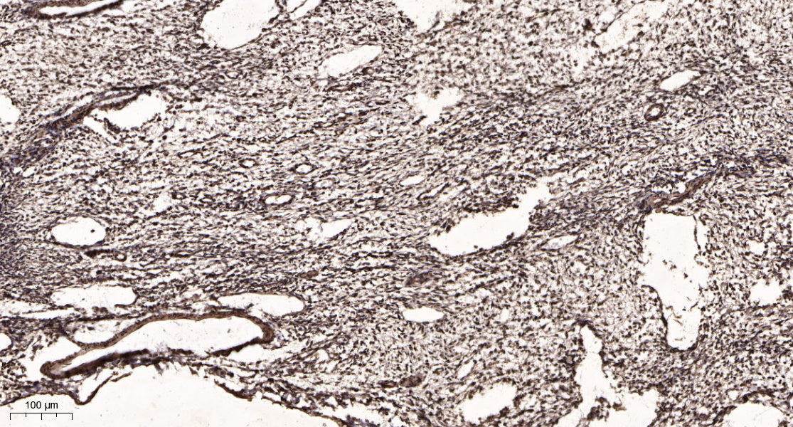 AMY-1 Rabbit Polyclonal Antibody