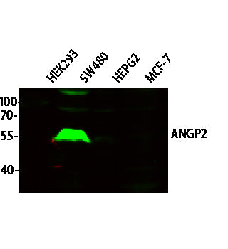 ANGP2 Rabbit Polyclonal Antibody