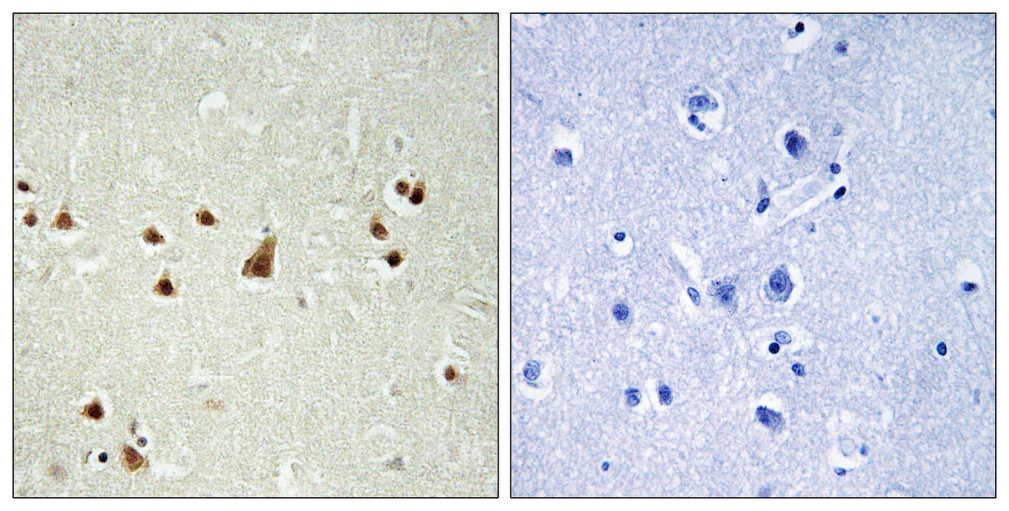 ANKRD26 Rabbit Polyclonal Antibody