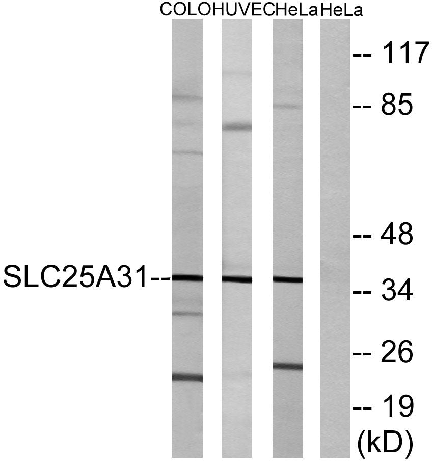 ANT4 Rabbit Polyclonal Antibody