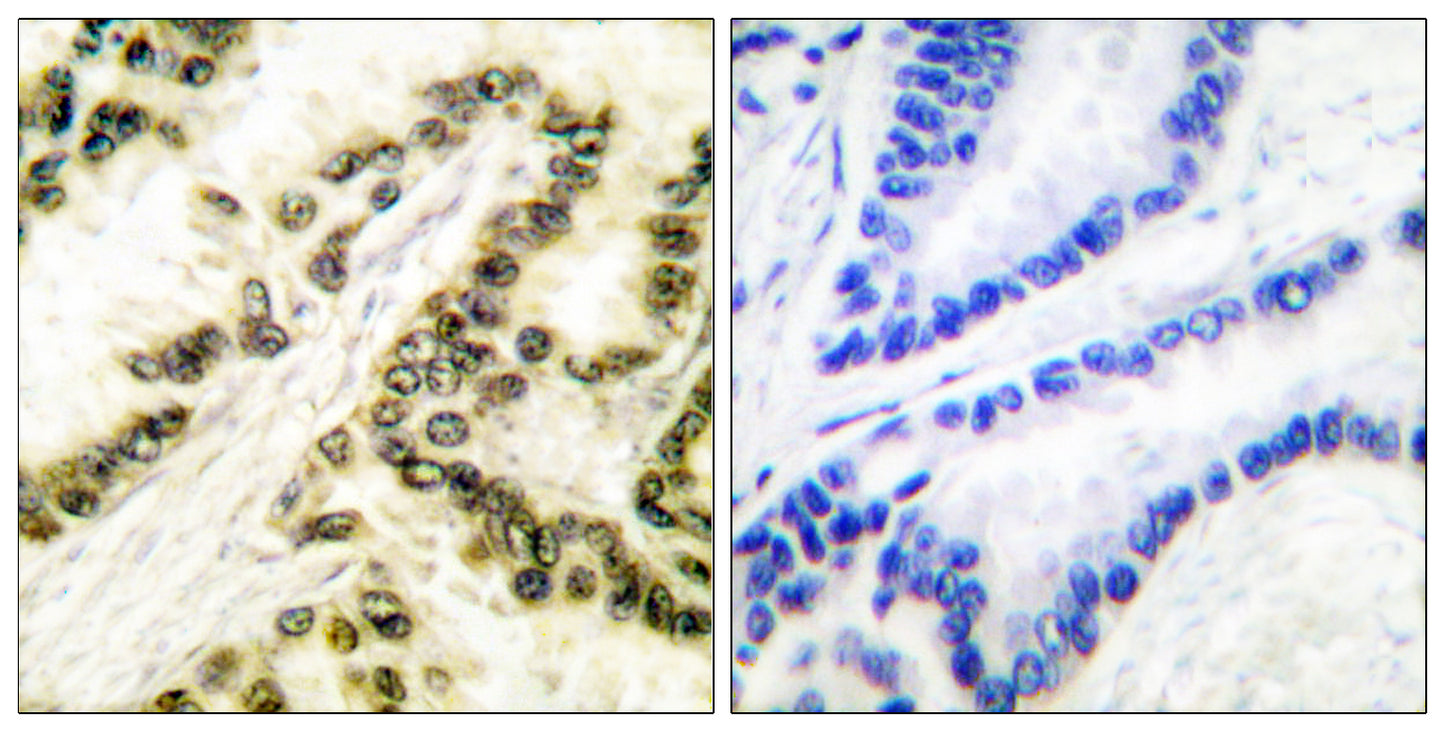 AP-2α/β Rabbit Polyclonal Antibody