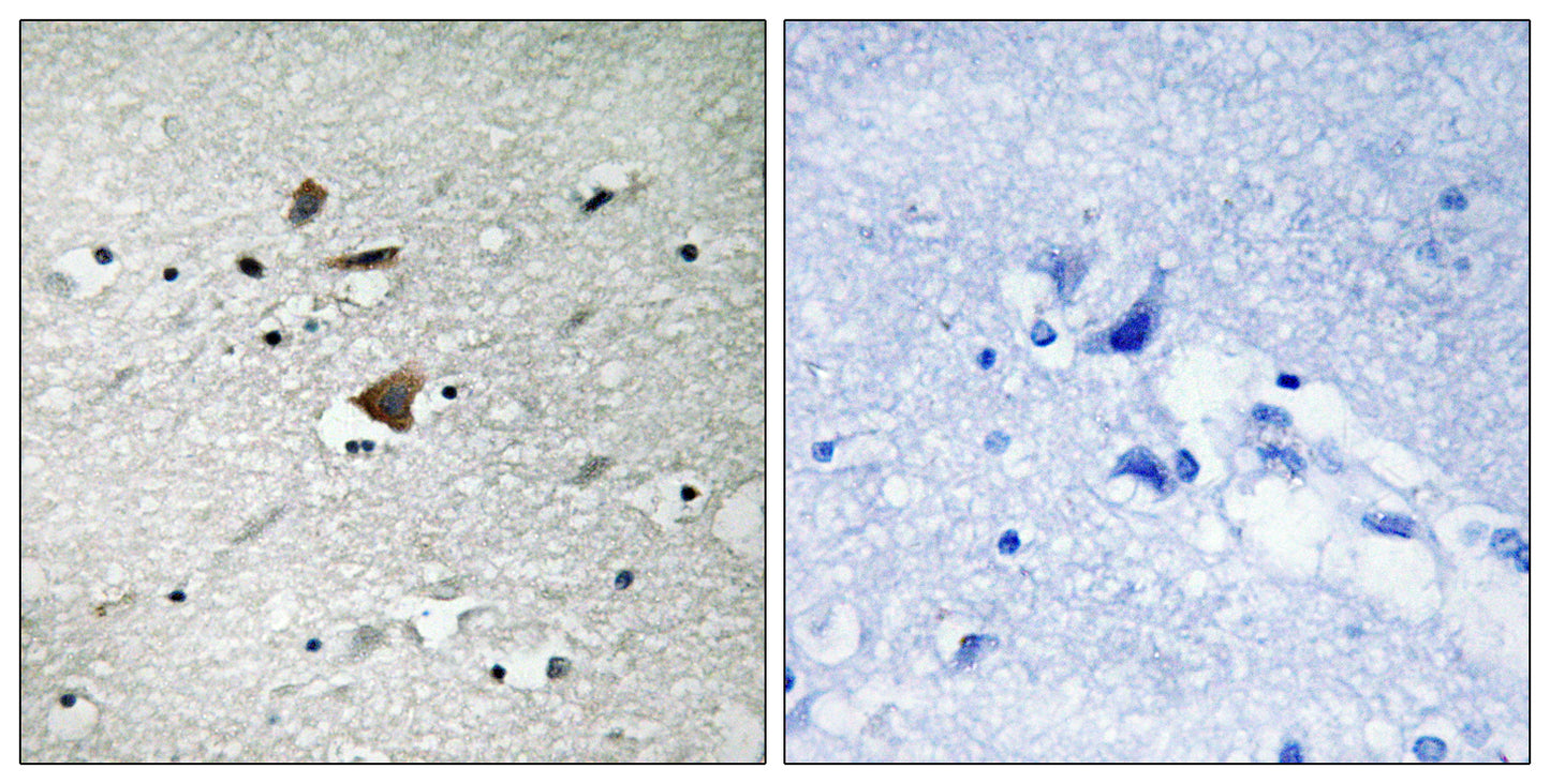 APC1 Rabbit Polyclonal Antibody
