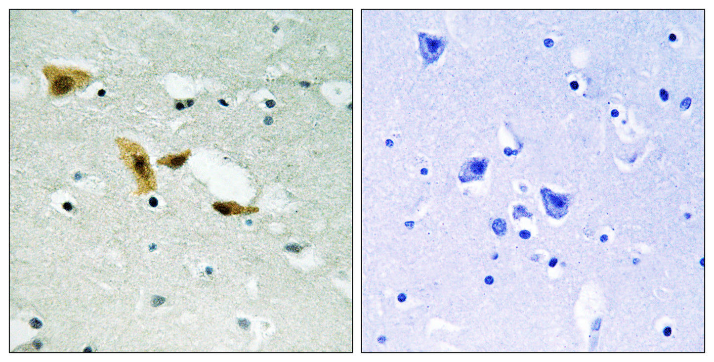 APLF Rabbit Polyclonal Antibody