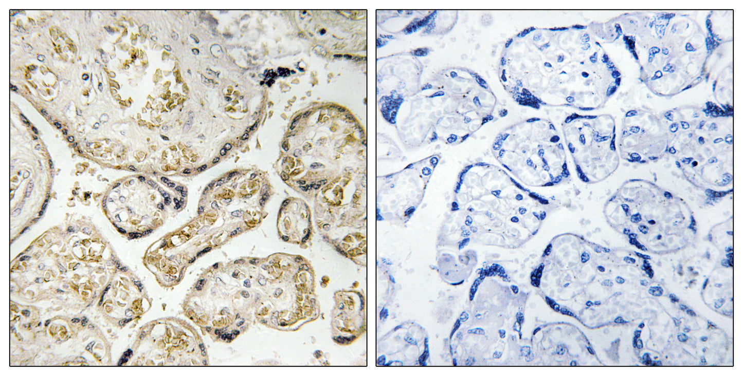APOBEC3D/F Rabbit Polyclonal Antibody