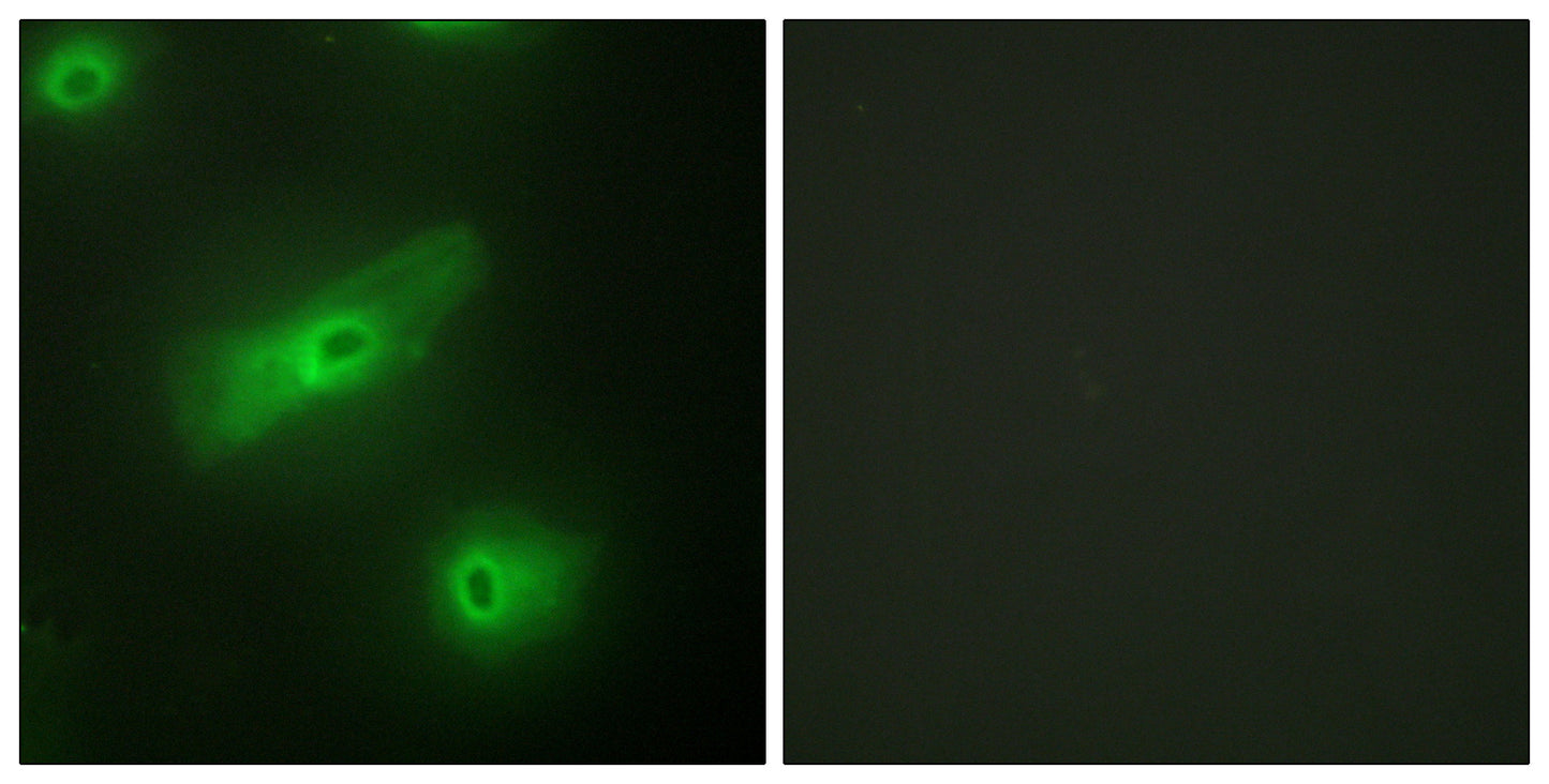 APRIL Rabbit Polyclonal Antibody