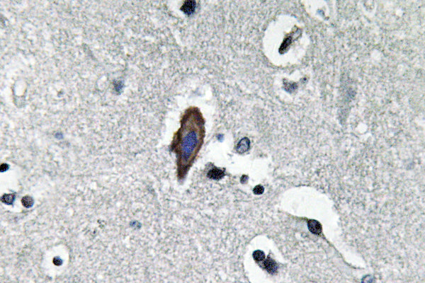 AQP0 Rabbit Polyclonal Antibody