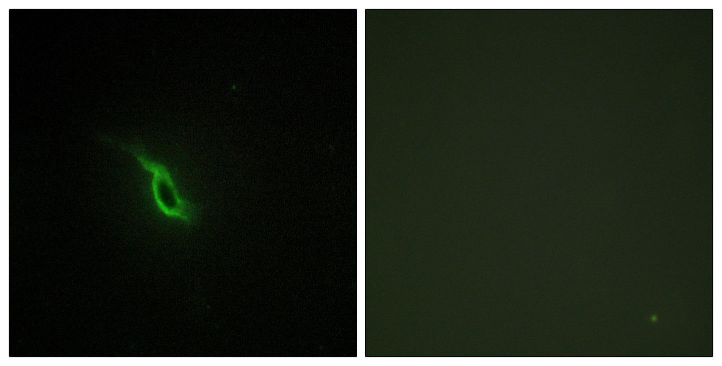 AR α2A Rabbit Polyclonal Antibody